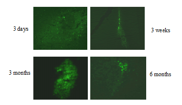Gene transfer vectors